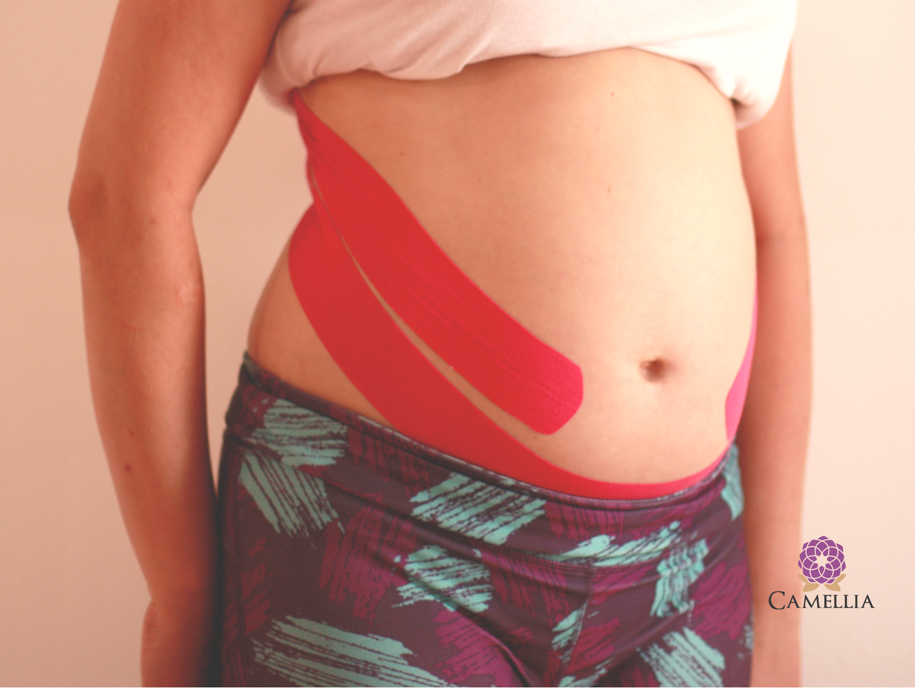 Kinesiotaping v tehotenstve
